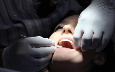 How to Know if You Need a Root Canal Treatment in Webster