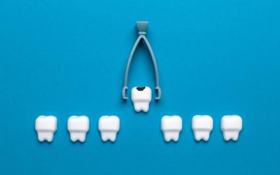 What to Expect Before, During, and After Your Tooth Extraction