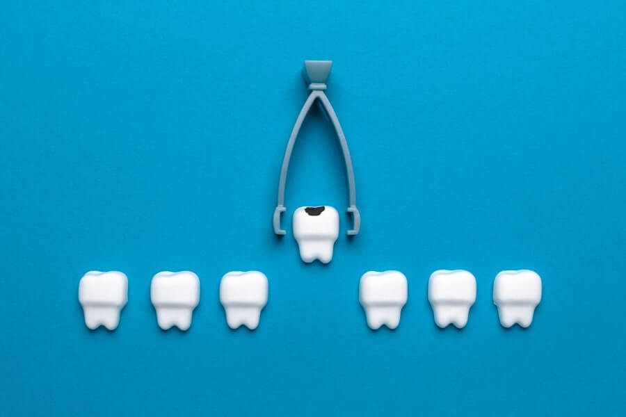 What to Expect Before, During, and After Your Tooth Extraction