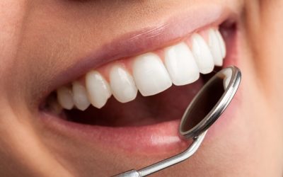 Why It’s Important to Keep Your Regularly Scheduled Dental Checkups