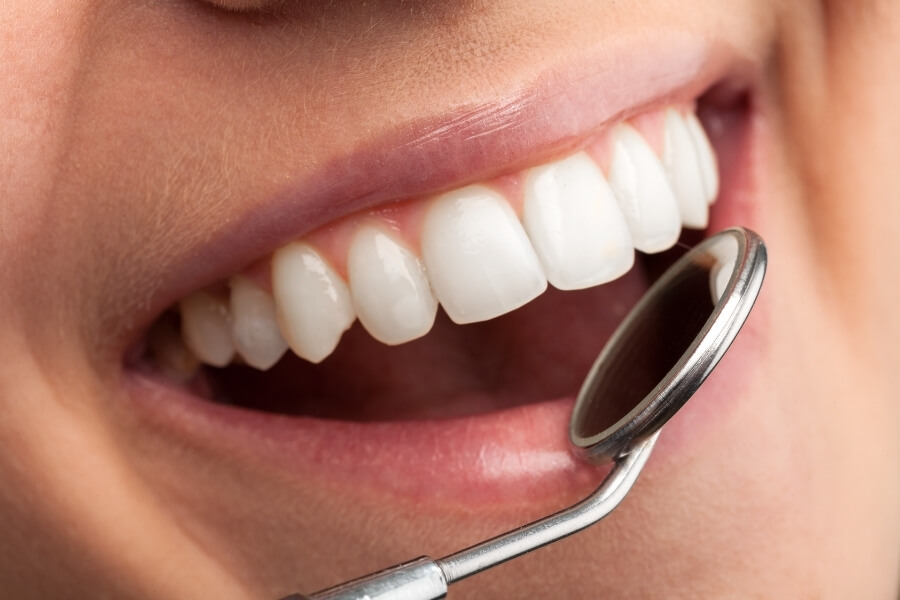 Why It’s Important to Keep Your Regularly Scheduled Dental Checkups