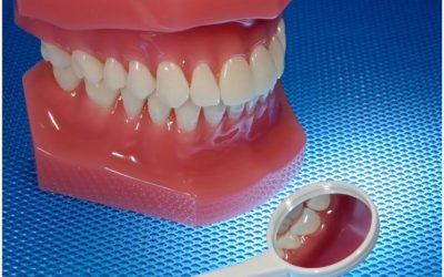 What Services are Available at an Office For General Dentistry in Webster?