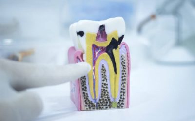 Can Tooth Root Problems Heal by Themselves?