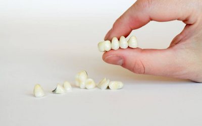 Porcelain Crowns in Webster: Why Choose Porcelain Over the Other Options?