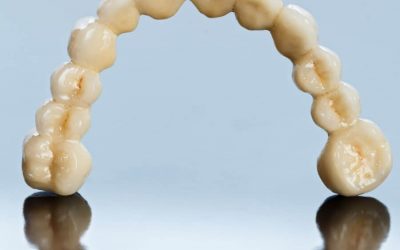 Advantages and Disadvantages of Dental Bridges in Webster
