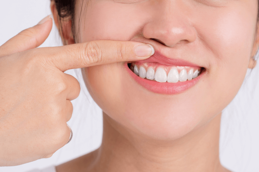 Should You Get Periodontal Therapy? The Facts About Gum Disease Treatment