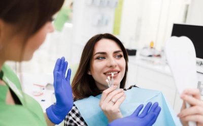 Factors to Consider Before Getting Porcelain Veneers in Webster