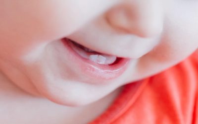Baby Teeth and Oral Health – Why Baby Teeth Matter
