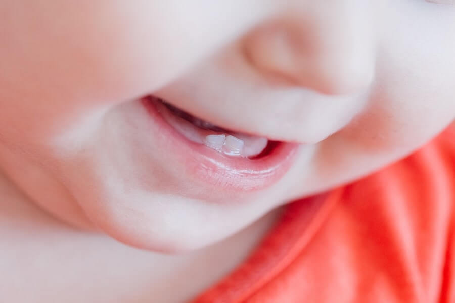 Baby Teeth and Oral Health – Why Baby Teeth Matter
