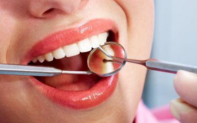 Dental Concerns for People in Their 30s and 40s