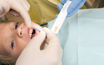 How Does Fluoride Affect Teeth?