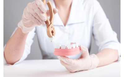 Most Common Reasons for Tooth Extraction in Webster