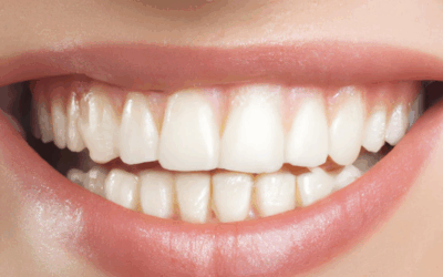 Cosmetic Dentistry in Webster: What Can It Fix?