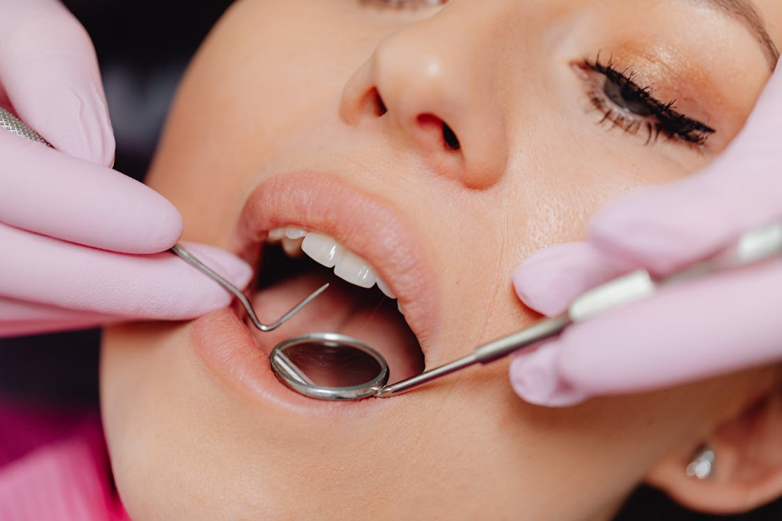 Porcelain Veneers in Webster Porcelain Veneers in Webster