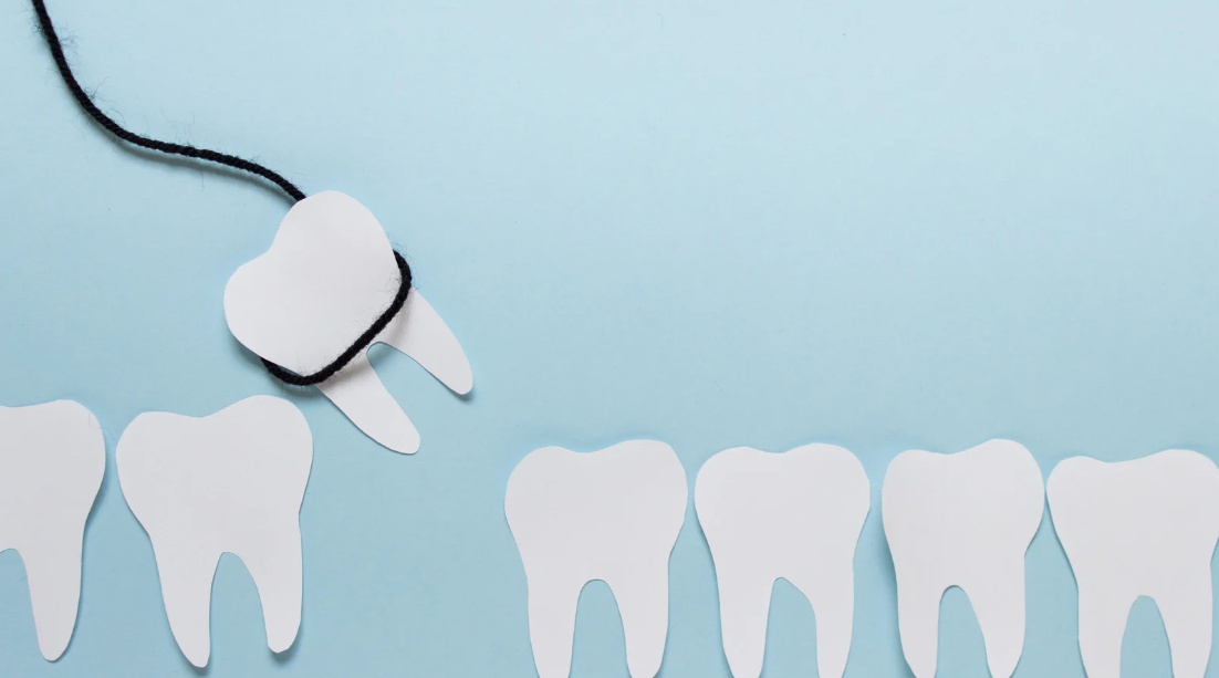 Replacing an Extracted Tooth