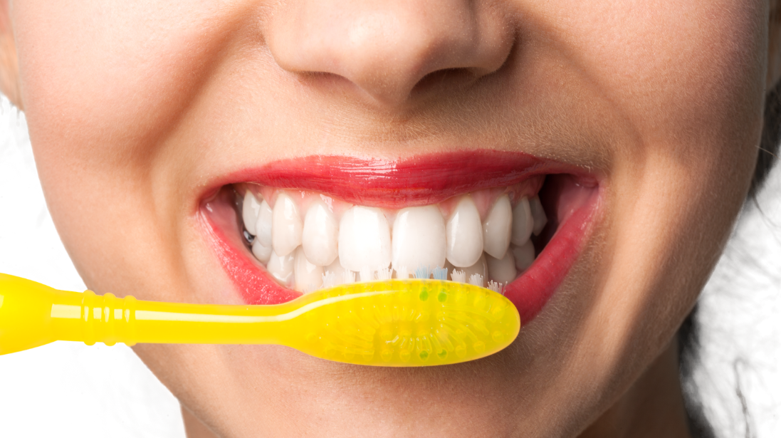 Tooth Whitening in Webster