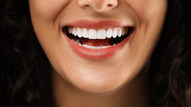 Porcelain Veneers in Webster-When Are They the Right Choice