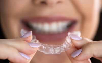 Mouthguards for Sports and Night Grinding: Do You Need One?
