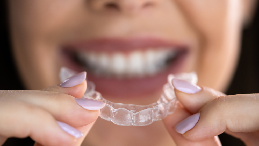 Mouthguards for Sports and Night Grinding Do You Need One