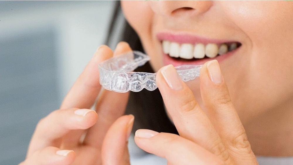 Custom Mouthguards in Webster Who Needs One and Why Custom Mouthguards in Webster Who Needs One and Why