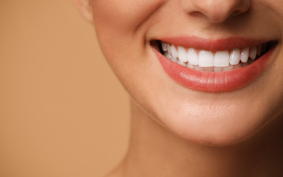 Porcelain Veneers vs. Teeth Whitening: Which Cosmetic Option Is Right for Your Smile?