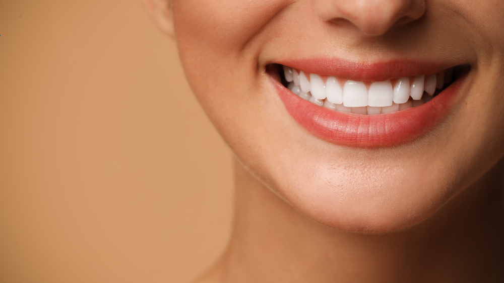 Porcelain Veneers vs Teeth Whitening Which Cosmetic Option Is Right for Your Smile Porcelain Veneers vs Teeth Whitening Which Cosmetic Option Is Right for Your Smile