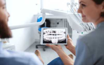 Why Dental X-Rays Are an Important Part of Preventive Care