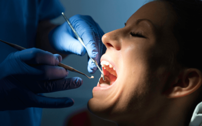 What Should You Do If a Filling Falls Out?